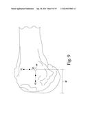 APPARATUS AND METHOD FOR CALIBRATING AN X-RAY IMAGE OF A KNEE OF A PATIENT diagram and image