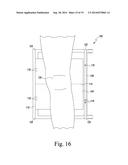 APPARATUS AND METHOD FOR CALIBRATING AN X-RAY IMAGE OF A KNEE OF A PATIENT diagram and image