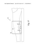 APPARATUS AND METHOD FOR CALIBRATING AN X-RAY IMAGE OF A KNEE OF A PATIENT diagram and image