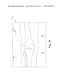 APPARATUS AND METHOD FOR CALIBRATING AN X-RAY IMAGE OF A KNEE OF A PATIENT diagram and image
