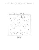 Methods and Systems for Hair Transplantation Using Time Constrained Image     Processing diagram and image