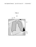 IMAGE PROCESSING DEVICE, RADIOGRAPHY APPARATUS, IMAGE PROCESSING METHOD,     AND NON-TRANSITORY STORAGE MEDIUM diagram and image