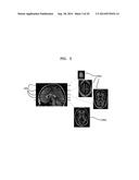 SYSTEM AND METHOD FOR AUTOMATIC PLANNING OF VIEWS IN 3D IMAGES OF BRAIN diagram and image