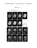 SYSTEM AND METHOD FOR AUTOMATIC PLANNING OF VIEWS IN 3D IMAGES OF BRAIN diagram and image