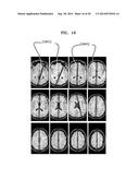 SYSTEM AND METHOD FOR AUTOMATIC PLANNING OF VIEWS IN 3D IMAGES OF BRAIN diagram and image