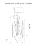 Vascular Data Processing and Image Registration Systems, Methods, and     Apparatuses diagram and image