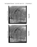 Vascular Data Processing and Image Registration Systems, Methods, and     Apparatuses diagram and image