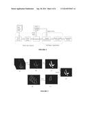 SYSTEMS, METHODS AND COMPUTER READABLE STORAGE MEDIA STORING INSTRUCTIONS     FOR AUTOMATICALLY SEGMENTING IMAGES OF A REGION OF INTEREST diagram and image