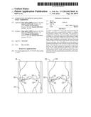 INTERACTIVE METHOD TO ASSESS JOINT SPACE NARROWING diagram and image