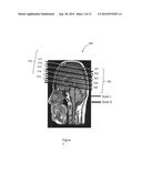 T2 SPECTRAL ANALYSIS FOR MYELIN WATER IMAGING diagram and image