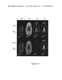 T2 SPECTRAL ANALYSIS FOR MYELIN WATER IMAGING diagram and image