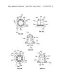 SYSTEMS AND METHODS FOR IMPROVING BOLTED JOINTS diagram and image