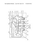 CPB Pump System With Double Y Tubing diagram and image