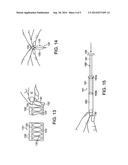 Topical Copper Ion Treatments and Methods of Treatment Using Topical     Copper Ion Treatments in the Oral-Respiratory-Otic Areas of the Body diagram and image