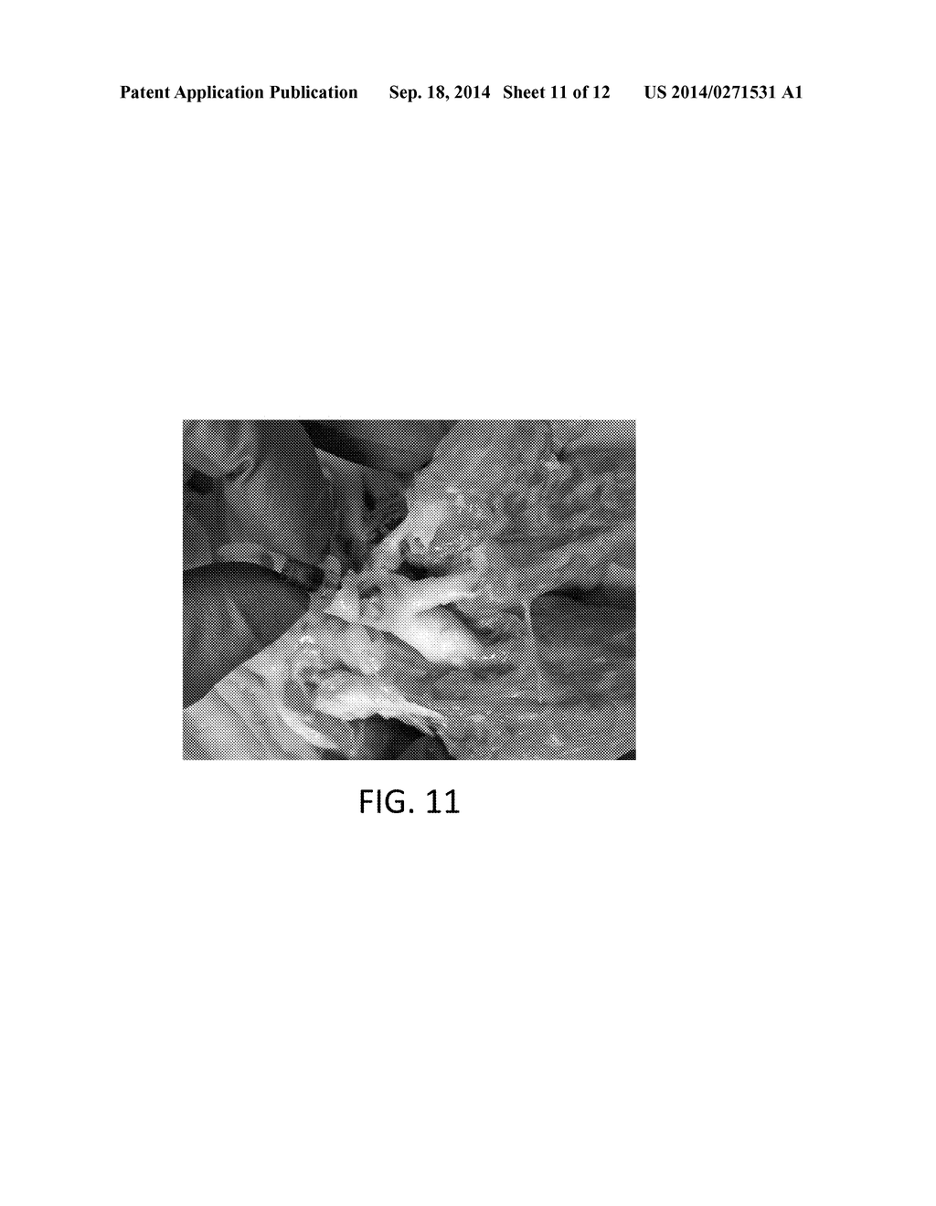 In-Situ Forming Foam for Endoscopic Lung Volume Reduction - diagram, schematic, and image 12