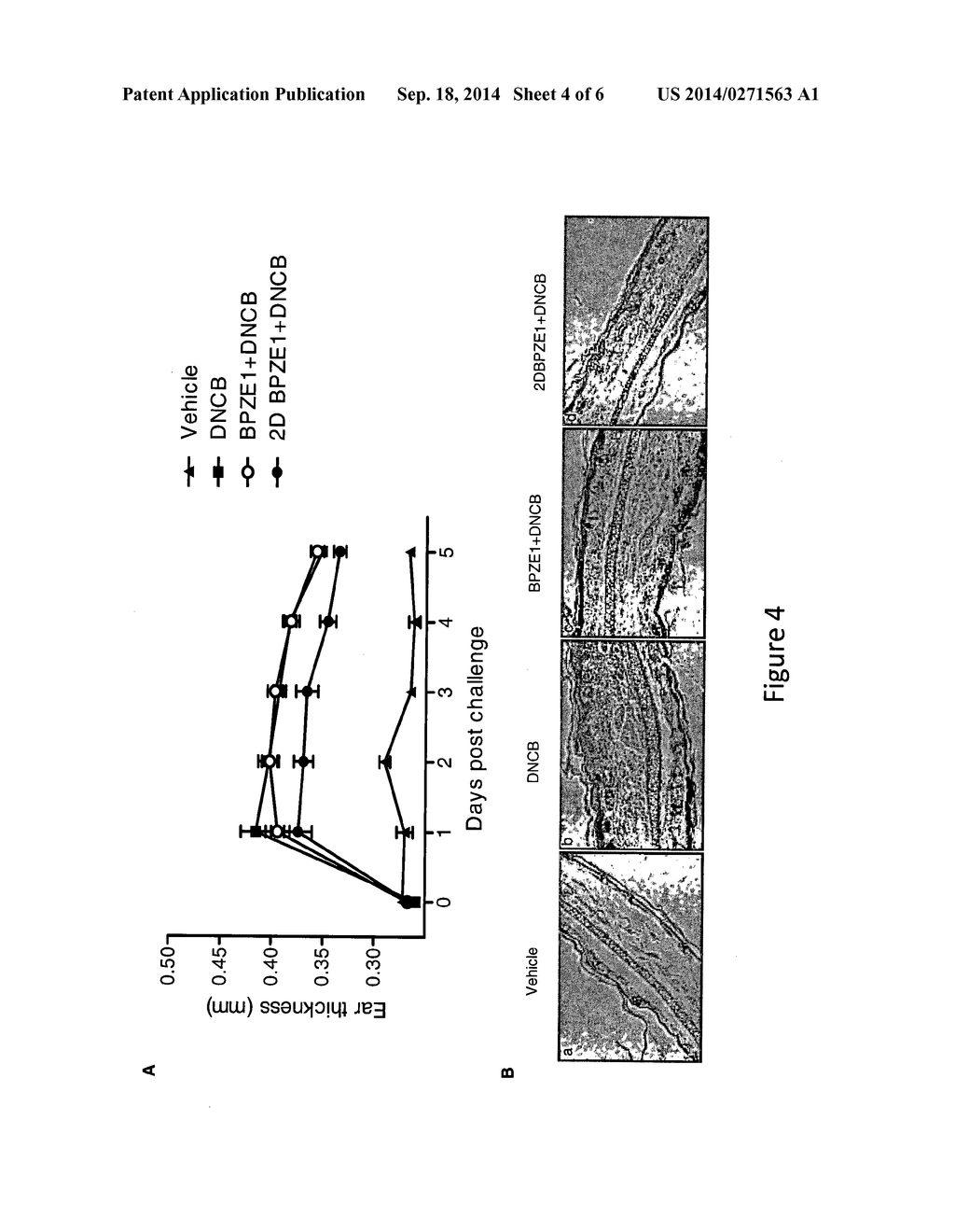 EFFECT OF AN ATTENUATED BORDETELLA STRAIN AGAINST ALLERGIC DISEASE - diagram, schematic, and image 05