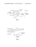 TREATMENT OF OPHTHALMIC CONDITIONS diagram and image