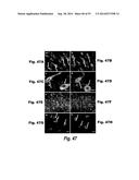 METHODS AND COMPOSITIONS FOR CNS DELIVERY OF IDURONATE-2-SULFATASE diagram and image