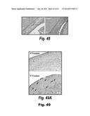 METHODS AND COMPOSITIONS FOR CNS DELIVERY OF IDURONATE-2-SULFATASE diagram and image