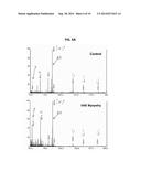 HYPOSIALYLATION DISORDERS diagram and image