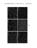 INCREASING PARKIN ACTIVITY BY ADMINISTERING A DEUBIQUITINATING ENZYME     INHIBITOR diagram and image