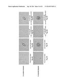 PEPTIDE VACCINE FOR PREVENTION AND IMMUNOTHERAPY OF DEMENTIA OF THE     ALZHEIMER S TYPE diagram and image