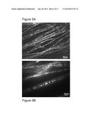 THERAPEUTIC ELECTROSPUN FIBER COMPOSITIONS diagram and image