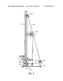 INTRAOCULAR SHUNT MANUFACTURE diagram and image