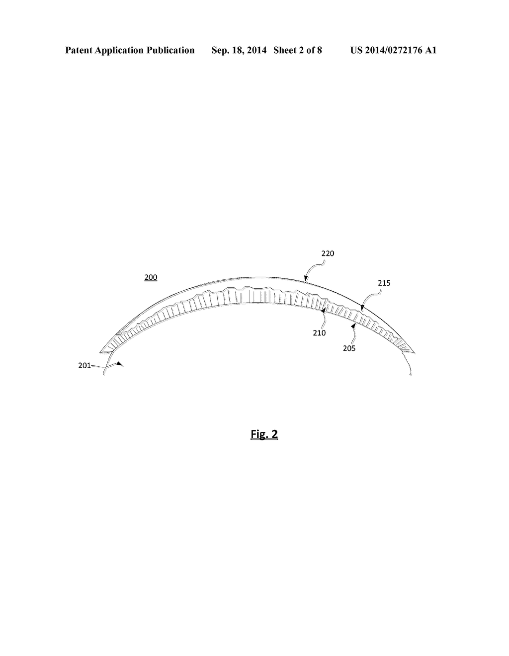 METHOD AND APPARATUS FOR SPATIALLY LOCATING LENS COMPONENTS ON A LENS     PRECURSOR - diagram, schematic, and image 03