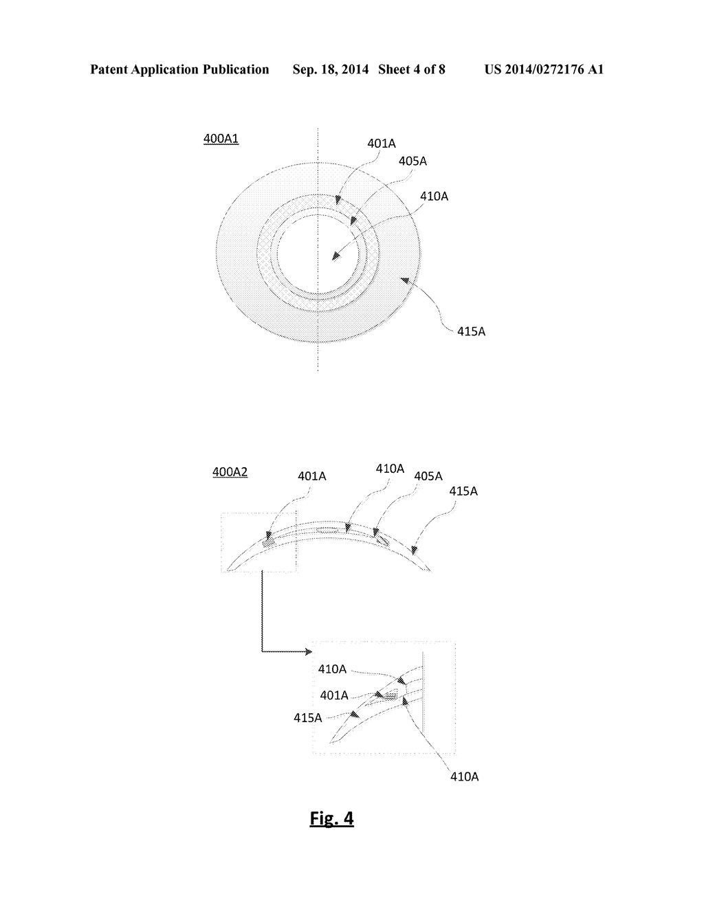 METHOD AND APPARATUS FOR SPATIALLY LOCATING LENS COMPONENTS ON A LENS     PRECURSOR - diagram, schematic, and image 05