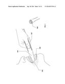 SPATIAL 3D STERIOSCOPIC INTRAORAL CAMERA SYSTEM BACKGROUND diagram and image