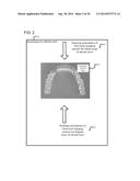 SCANNING SEQUENCE FOR AN INTRA-ORAL IMAGING SYSTEM diagram and image