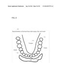 SCANNING SEQUENCE FOR AN INTRA-ORAL IMAGING SYSTEM diagram and image