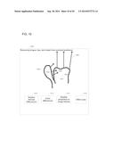 SCANNING SEQUENCE FOR AN INTRA-ORAL IMAGING SYSTEM diagram and image