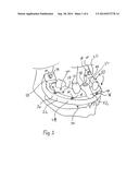 BONE FOUNDATION GUIDE AND METHOD OF USE diagram and image