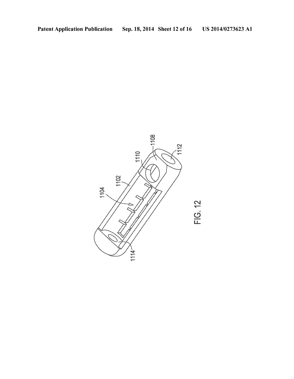 Distal Connector Assemblies for Medical Lead Extensions - diagram, schematic, and image 13