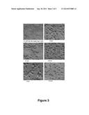 MOSQUITOCIDAL XENORHABDUS, LIPOPEPTIDE AND METHODS diagram and image