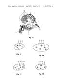 Resorbable Oxidized Cellulose Embolization Microspheres diagram and image