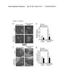 THE miRNA-212/132 FAMILY AS A THERAPEUTIC TARGET diagram and image