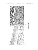 BIOCOMPATIBLE AND BIOABSORBABLE DERIVATIZED CHITOSAN COMPOSITIONS diagram and image