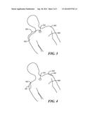 Method and Apparatus for Using a Designated Patient Structure as an Area     to be Masked From Radiation diagram and image