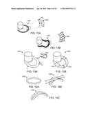 INTRA-VAGINAL DEVICES AND METHODS FOR TREATING FECAL INCONTINENCE diagram and image