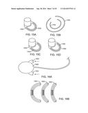 INTRA-VAGINAL DEVICES AND METHODS FOR TREATING FECAL INCONTINENCE diagram and image