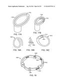 INTRA-VAGINAL DEVICES AND METHODS FOR TREATING FECAL INCONTINENCE diagram and image