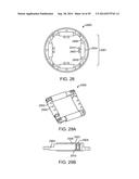 INTRA-VAGINAL DEVICES AND METHODS FOR TREATING FECAL INCONTINENCE diagram and image