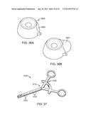 INTRA-VAGINAL DEVICES AND METHODS FOR TREATING FECAL INCONTINENCE diagram and image