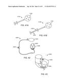 INTRA-VAGINAL DEVICES AND METHODS FOR TREATING FECAL INCONTINENCE diagram and image