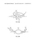 INTRA-VAGINAL DEVICES AND METHODS FOR TREATING FECAL INCONTINENCE diagram and image