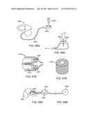 INTRA-VAGINAL DEVICES AND METHODS FOR TREATING FECAL INCONTINENCE diagram and image