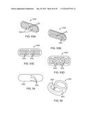 INTRA-VAGINAL DEVICES AND METHODS FOR TREATING FECAL INCONTINENCE diagram and image